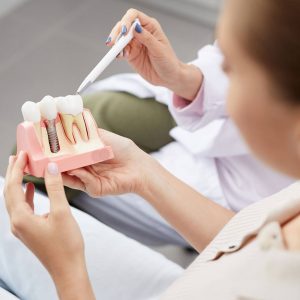 Dental Implant