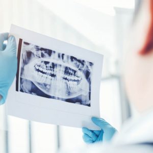 CT Scan And X-rays